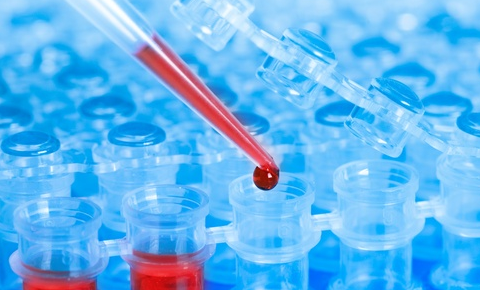 抗生素耐药性基因测试获得FDA突破性提名